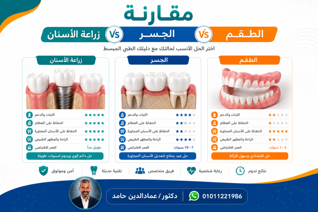 مقارنة بين زراعة الأسنان وجسر الأسنان وطقم الأسنان المتحرك